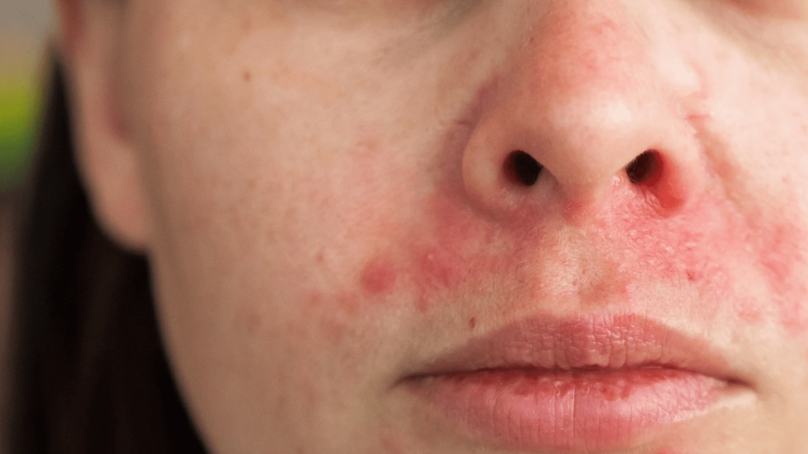 Ускладнення в естетичній медицині