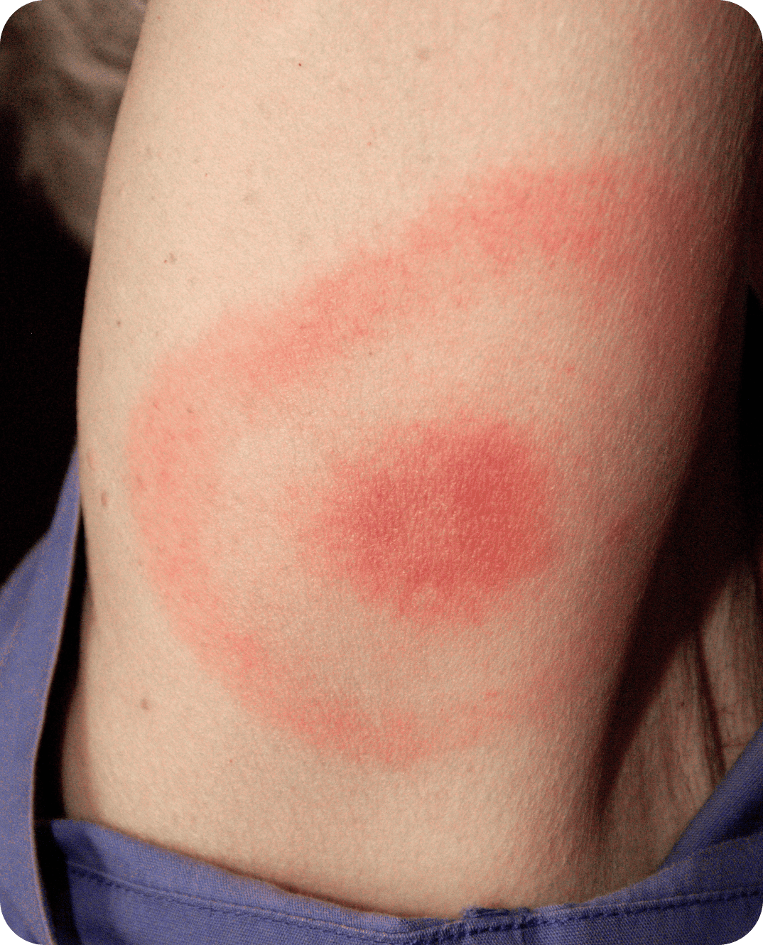 Діагностика паразитозів