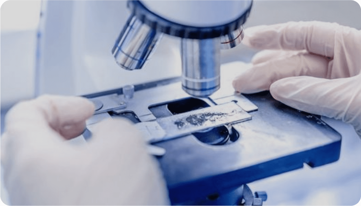 Діагностика хвороби Лайма